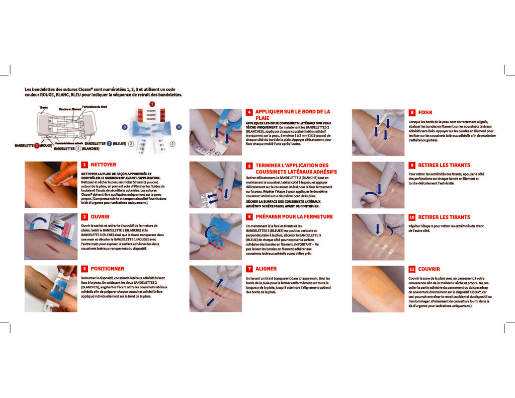 Instructions To Use Electronic Instructions For Use – Clozex Medical, Inc.
